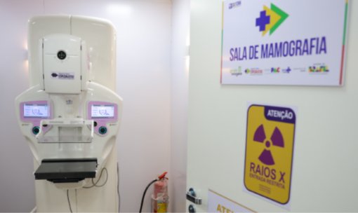 SUS amplia acesso à mamografia e ao tratamento do câncer de mama